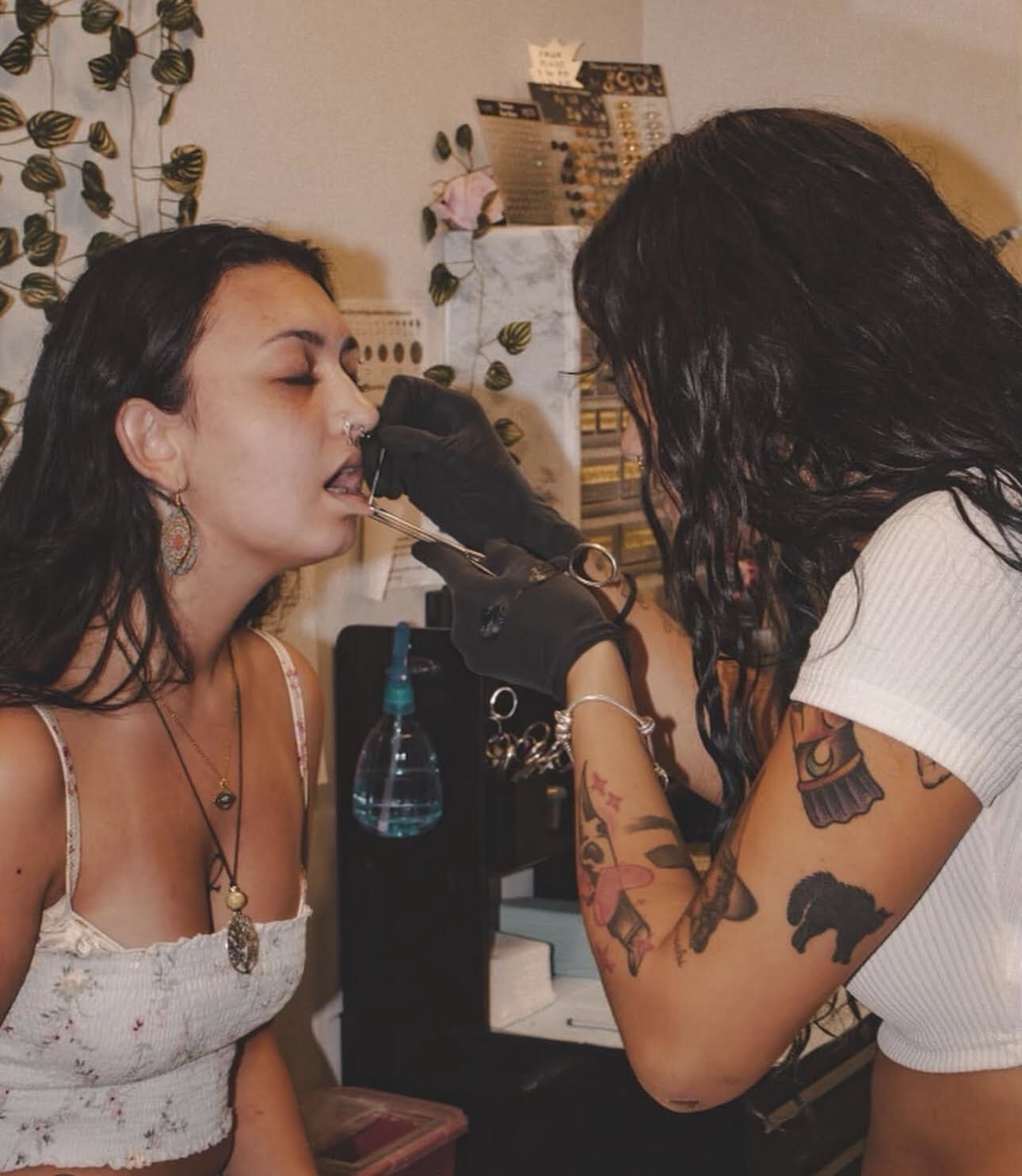 Vertical Labret Procedure