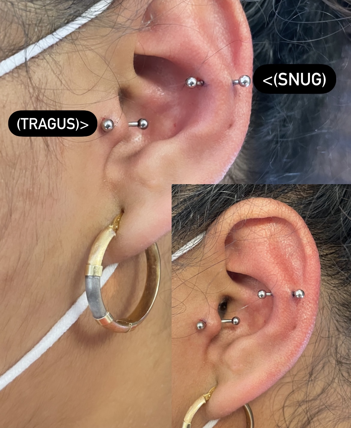 Tragus & Snug